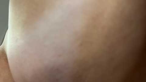 Media: Close-up video of a person's bare torso showing skin tones that are lighter on the right and darker on the left, possibly indicating sunburn or natural skin pigmentation.