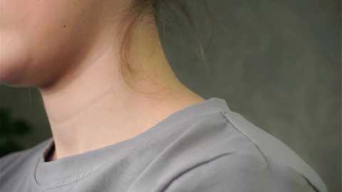 Media: Video of a woman's neck and upper chest, showing a faint, pinkish tan line where a strapless dress may have been. She has fair skin and wears a light gray shirt. Background is out of focus, with a hint of greenery.