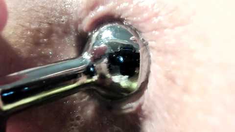 Media: Video of a close-up view of a human eye with a metallic instrument inserted into the pupil, causing a black dot to appear. The eye is surrounded by skin and eyelashes.