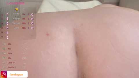 Media: A close-up video of a person's bare buttocks, showing a few small pimples, with a social media app screen overlay featuring \"Amaingran\" and a red heart icon.