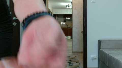 Media: Video of a person with a red, swollen hand, wearing a black bracelet, walking through a modern, open-plan kitchen with beige tiles and a light-colored couch in the background.