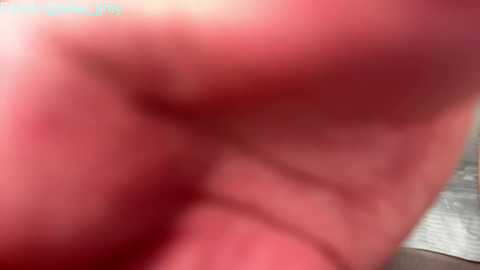 Media: This blurred video shows a close-up of a person's skin, possibly of a man, with visible redness and slight swelling, suggesting recent skin irritation or rash. The background is indistinct.