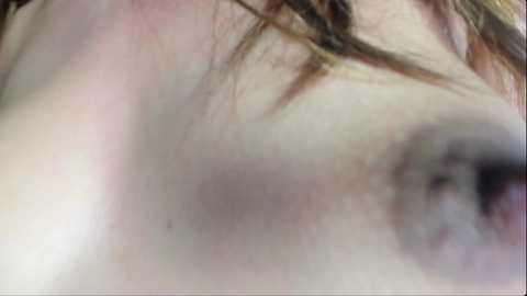 Media: A close-up video of a person's face with fair skin, showing a prominent red rash on the left cheek and a portion of their eye. The background is blurred, focusing attention on the skin condition.