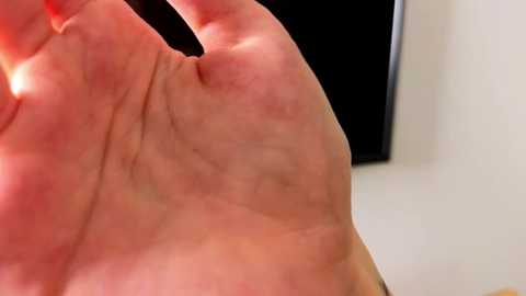 Media: A close-up video of a Caucasian male hand with a reddened, swollen knuckle, likely from repetitive stress or injury. The background features a blurred, black-framed television screen and a white wall.