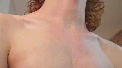 Media: Video of a fair-skinned person with wavy red hair, showcasing a sunburn on their neck and upper back. The background is blurred, with soft lighting highlighting the redness and skin texture.