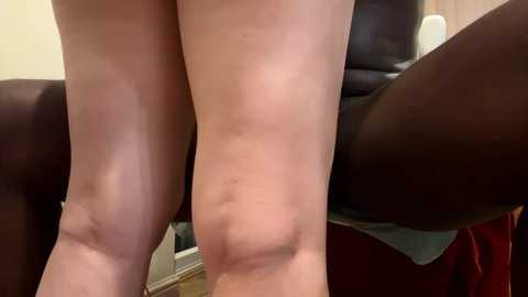 Media: A video of a person's legs, showing cellulite and dimples, standing in a room with a brown leather chair and a beige wall in the background.