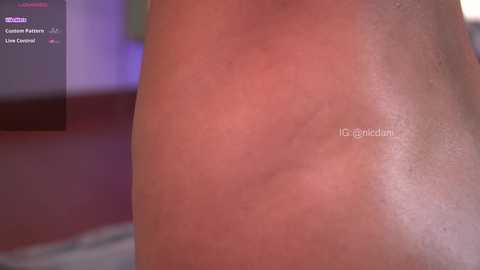 Media: Video of a person's reddened, sunburned back, with the watermark \"1girldream\" visible. The background is blurred, featuring a TV screen displaying a purple and white menu, possibly from a gaming console.