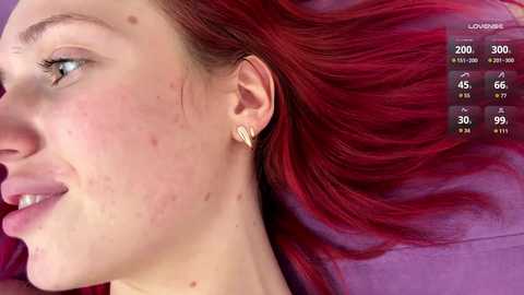 Video of a close-up side profile of a young woman with fair skin, red hair, and acne. She wears small gold hoop earrings. The background shows a purple bedspread.