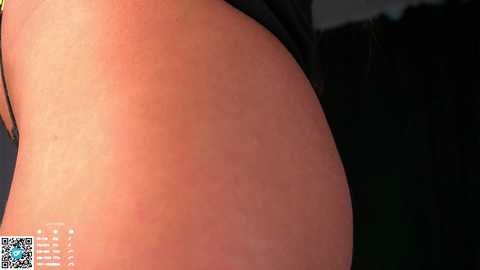 Media: Video of a close-up of a light-skinned person's buttocks, showing a red, irritated rash on the right side. The background is dark and indistinct, with a QR code in the bottom left corner.