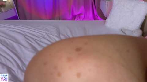 Media: Video of a person lying on their back on a white bed, showcasing their large, round, and slightly dimpled belly with acne. The background features a bed with a white pillow, purple curtains, and a nightstand with a lamp.