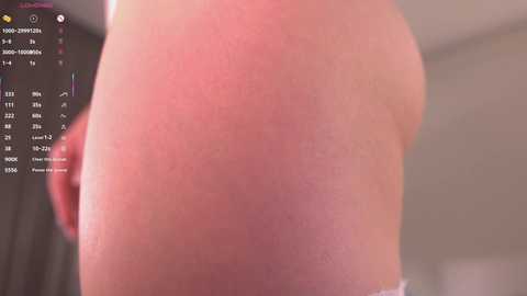 Video of a close-up of a person's buttocks with visible redness and slight swelling, possibly indicating irritation or rash. Background includes a blurred indoor setting with a calendar and weather app interface visible on a smartphone.