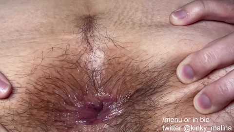 Close-up video of a person's vulva with pubic hair, hands spreading the labia, showing a natural appearance with visible skin texture and color variations.