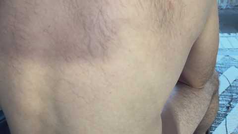 Video of a close-up of a person's back, showing fair skin with slight redness and some hair, with a hand resting on the right side. Background includes a striped cloth.