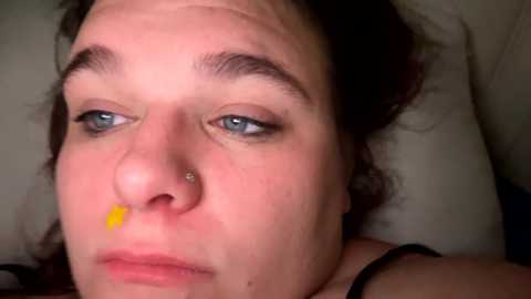 Video of a woman with fair skin, blue eyes, and dark hair, lying on a pillow, wearing a yellow bandage on her nose. She appears tired, with a slight frown.